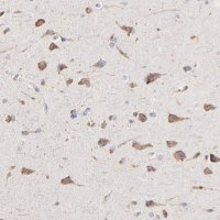 Anti-RNF213 antibody produced in rabbit 