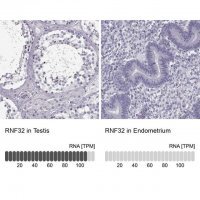 Anti-RNF32 antibody produced in rabbit 