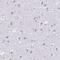 Anti-RNFT2 antibody produced in rabbit HPA064161-100UL