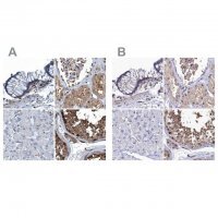 Anti-RNH1 antibody produced in rabbit HPA039223-100UL