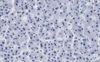 Anti-ROR Antibody, clone 1D13 ZooMAb� Rabbit Monoclonal 