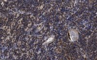Anti-ROR Antibody, clone 6F3.1 ZooMAb� Mouse Monoclonal 