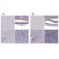 Anti-RP1L1 antibody produced in rabbit 