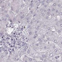 Anti-RP1L1 antibody produced in rabbit 