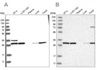 Anti-RPA2 antibody produced in rabbit 