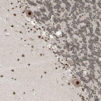 Anti-RPAIN antibody produced in rabbit 