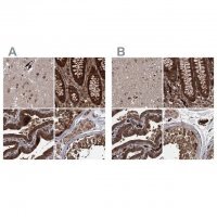 Anti-RPAP3 antibody produced in rabbit 
