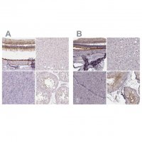 Anti-RPGRIP1 antibody produced in rabbit