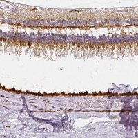 Anti-RPGRIP1 antibody produced in rabbit