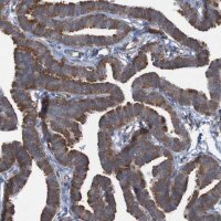 Anti-RPL10 antibody produced in rabbit HPA011311-100UL