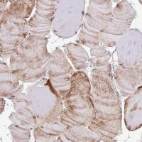 Anti-RPL3L antibody produced in rabbit