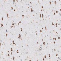 Anti-RPLP1 antibody produced in rabbit 