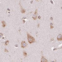 Anti-RPN1 antibody produced in rabbit HPA051520-100UL