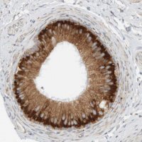 Anti-RPN2 antibody produced in rabbit HPA025922-100UL