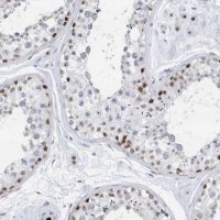 Anti-RPP30 antibody produced in rabbit