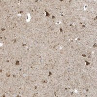 Anti-RPP40 antibody produced in rabbit 