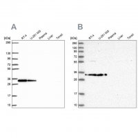 Anti-RPS3A antibody produced in rabbit HPA053454-100UL