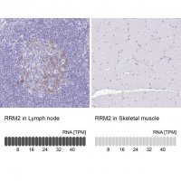 Anti-RRM2 antibody produced in rabbit