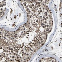 Anti-RRP1B antibody produced in rabbit 