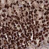 Anti-RRP36 antibody produced in rabbit 