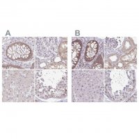 Anti-RSL24D1 antibody produced in rabbit 