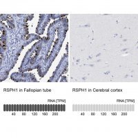 Anti-RSPH1 antibody produced in rabbit