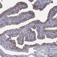 Anti-RSPH14 antibody produced in rabbit