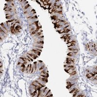 Anti-RSPH4A antibody produced in rabbit