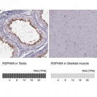 Anti-RSPH6A antibody produced in rabbit 