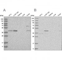 Anti-RTCA antibody produced in rabbit HPA027982-100UL