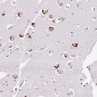 Anti-RTFDC1 antibody produced in rabbit HPA053986-100UL
