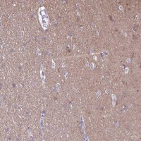 Anti-RTN1 antibody produced in rabbit 
