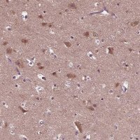 Anti-RUFY3 antibody produced in rabbit