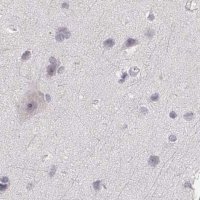 Anti-RUNDC3A antibody produced in rabbit