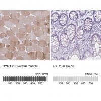 Anti-RYR1 antibody produced in rabbit 
