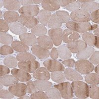 Anti-RYR1 antibody produced in rabbit 