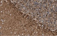 Anti-S100-B Antibody, clone 8F20 ZooMAb� Rabbit Monoclonal 