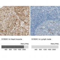Anti-S100A1 antibody produced in rabbit 