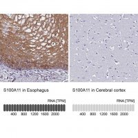 Anti-S100A11 antibody produced in rabbit 