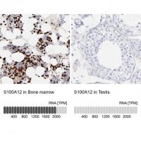 Anti-S100A12 antibody produced in rabbit 