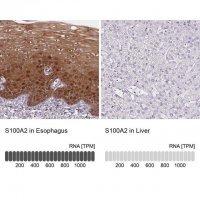 Anti-S100A2 antibody produced in rabbit HPA062451-100UL