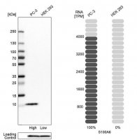Anti-S100A6 antibody produced in rabbit 