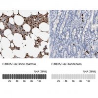 Anti-S100A8 antibody produced in rabbit 