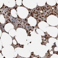 Anti-S100A8 antibody produced in rabbit 