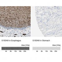 Anti-S100A9 antibody produced in rabbit 