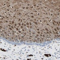 Anti-S100A9 antibody produced in rabbit 