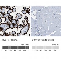 Anti-S100P antibody produced in rabbit 