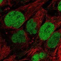 Anti-SAAL1 antibody produced in rabbit