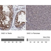 Anti-SAE1 antibody produced in rabbit 