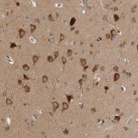 Anti-SAMD12 antibody produced in rabbit